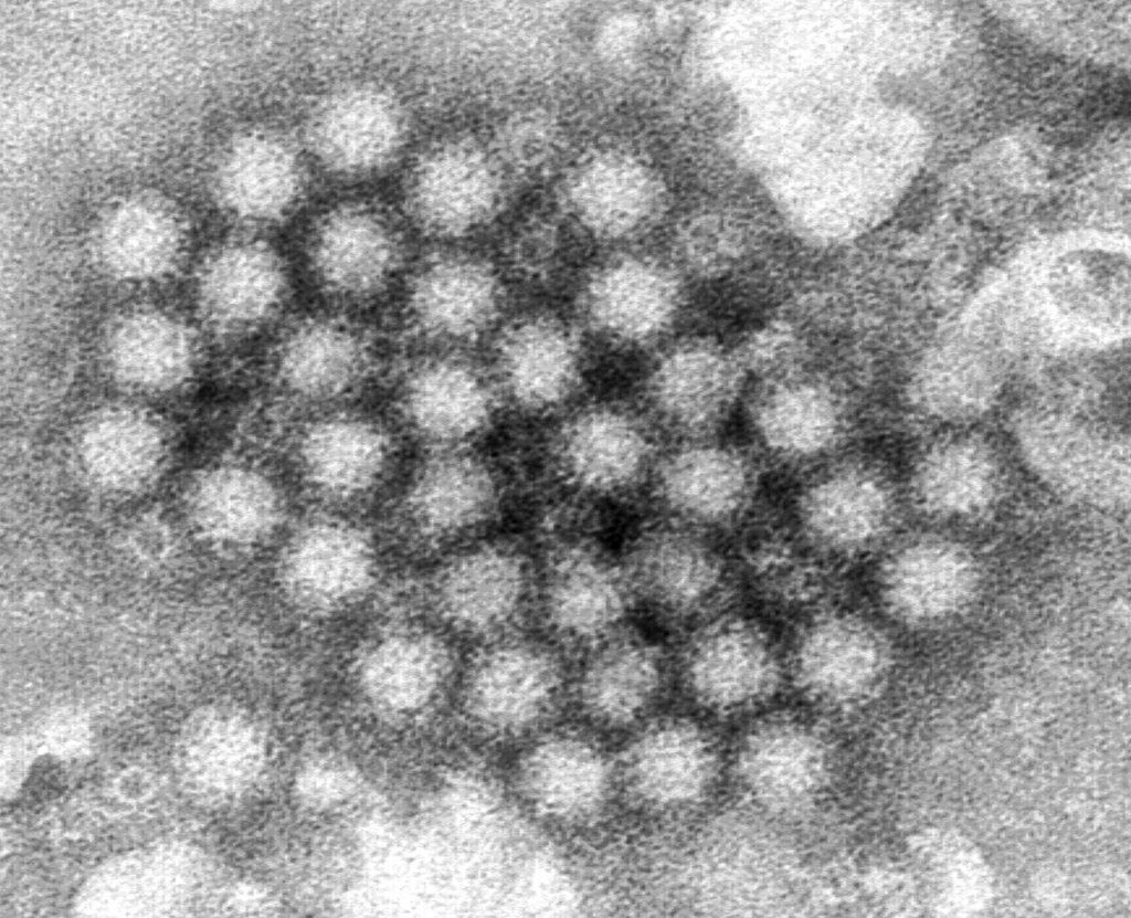 Nasty norovirus is back in full force with U.S. cases of the stomach virus surging
