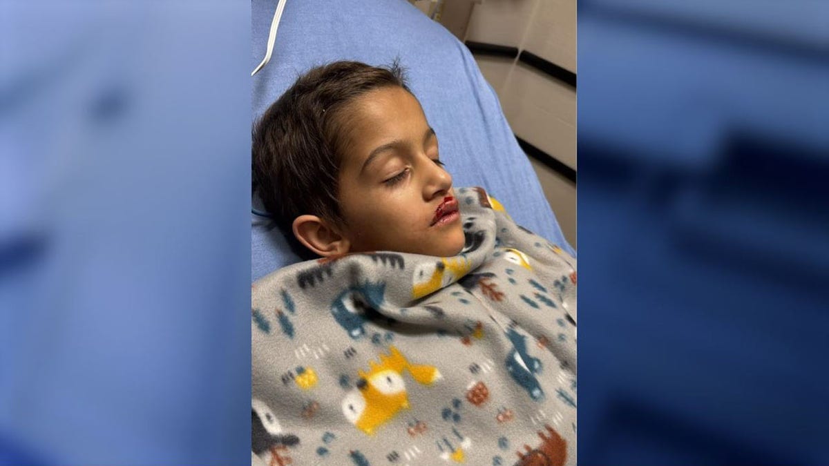 A 7-year-old boy has undergone heart surgery after he was struck by a falling drone, his parents said.