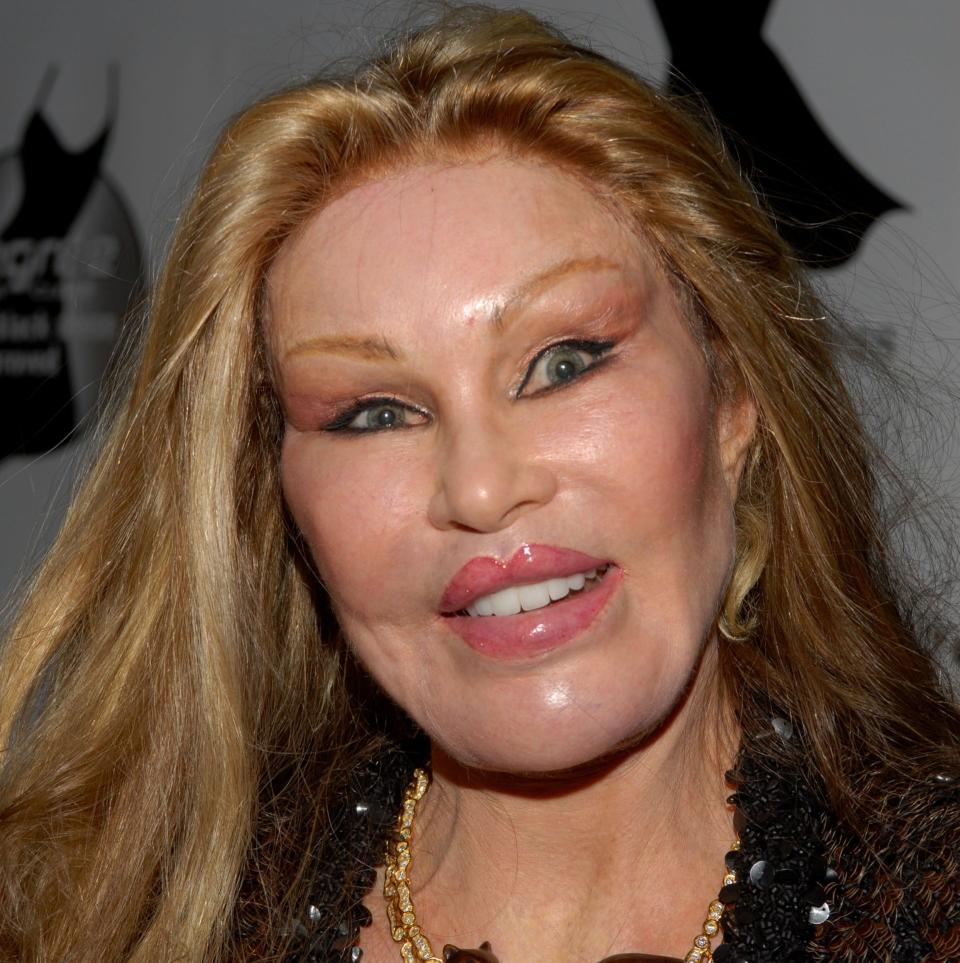 Jocelyn Wildenstein