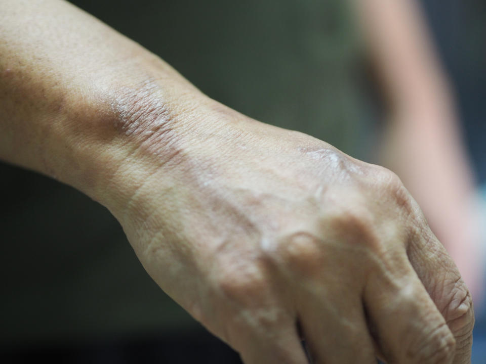 Close-up of a person's hand with visible skin texture and veins, resting in a relaxed position