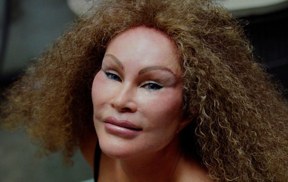 Jocelyn Wildenstein