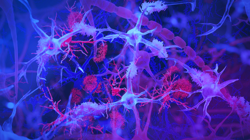 Scientists Discover Common Virus Could Be Causing a Type of Alzheimer’s